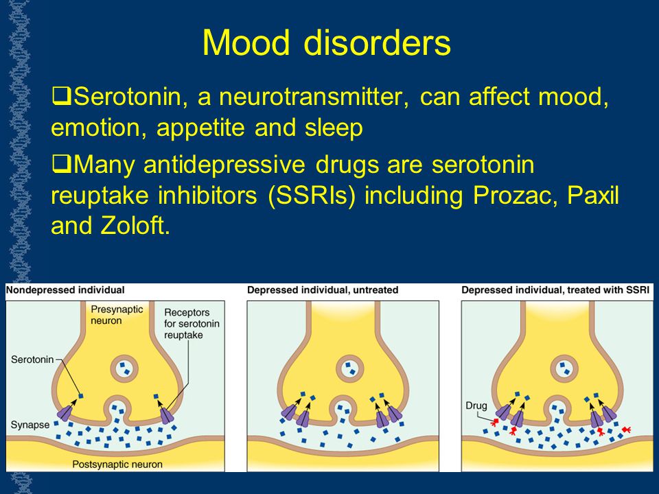 Overdose on wellbutrin amount